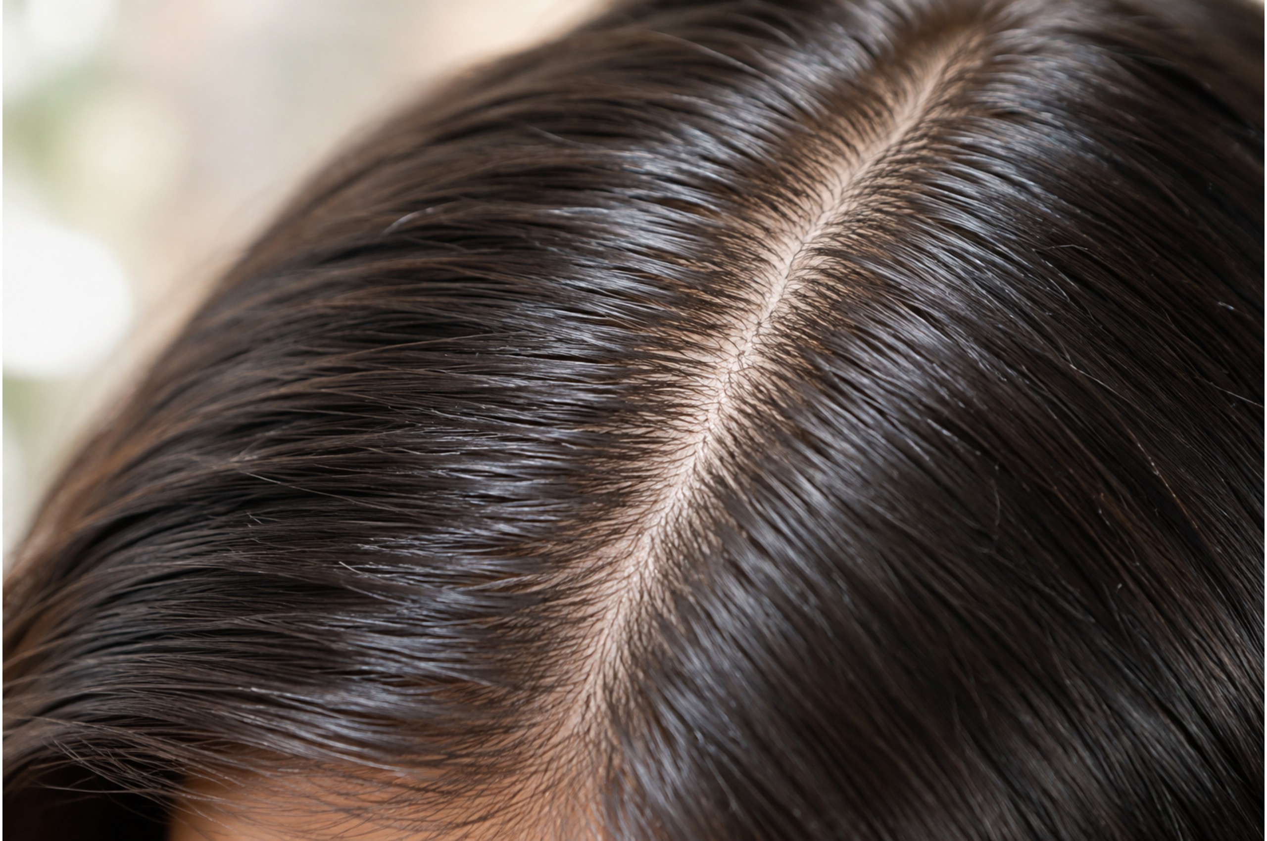 Close-up of a clean, healthy scalp parting